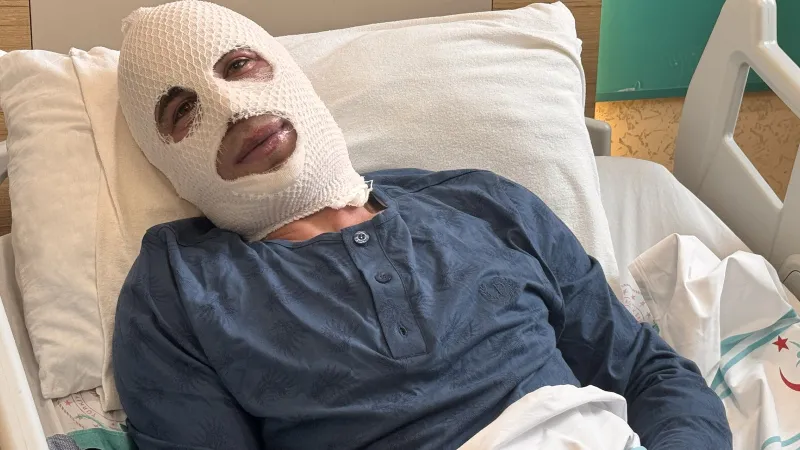 Erzurum'da korkunç olay! Ocakta ısıttığı sprey boya tüpünün patlaması sonucu hayatı kabusa döndü